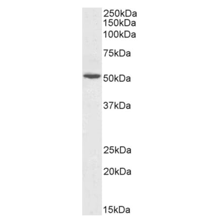 Western Blot - Anti-Alanine Transaminase Antibody (A85249) - Antibodies.com