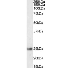 Western Blot - Anti-GSTA4 Antibody (A85250) - Antibodies.com