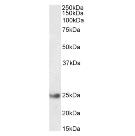 Western Blot - Anti-GSTA4 Antibody (A85250) - Antibodies.com