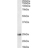 Western Blot - Anti-GSTA4 Antibody (A85250) - Antibodies.com