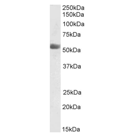 Western Blot - Anti-Kynurenine 3-Monooxygenase Antibody (A85251) - Antibodies.com