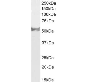 Western Blot - Anti-LCAT Antibody (A85253) - Antibodies.com