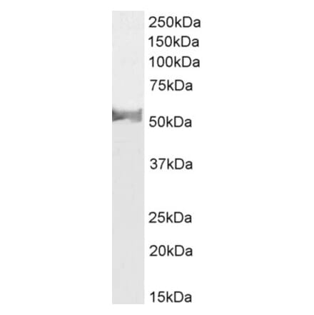 Western Blot - Anti-LCAT Antibody (A85253) - Antibodies.com