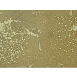 Immunohistochemistry - Anti-LCAT Antibody (A85253) - Antibodies.com