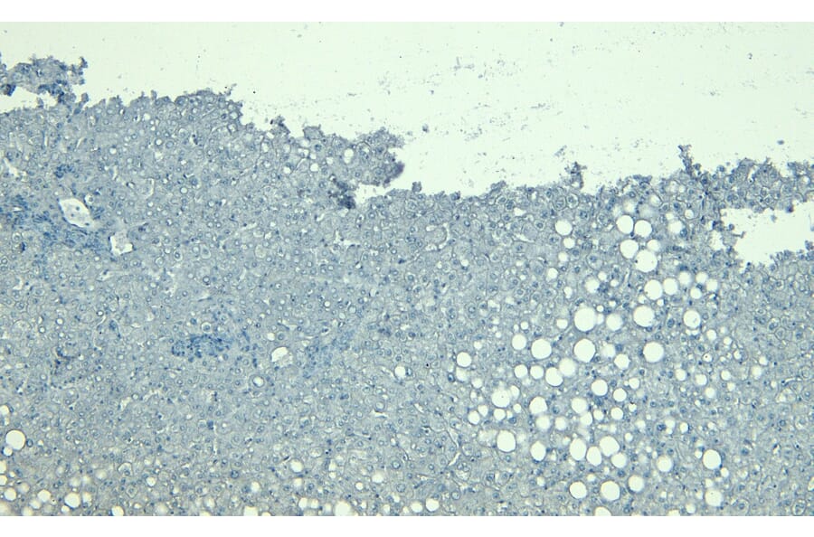 Immunohistochemistry - Anti-LCAT Antibody (A85253) - Antibodies.com