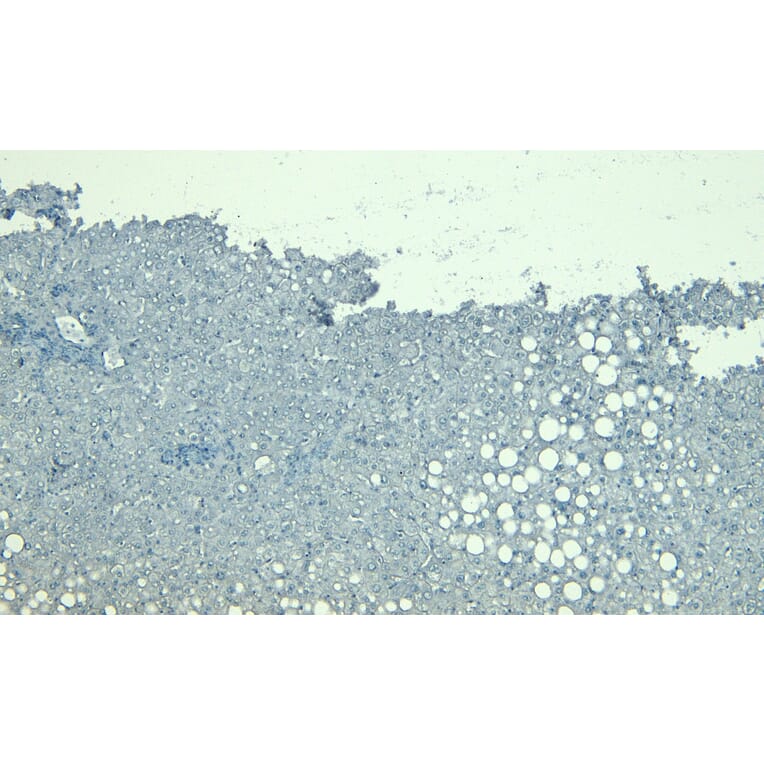 Immunohistochemistry - Anti-LCAT Antibody (A85253) - Antibodies.com