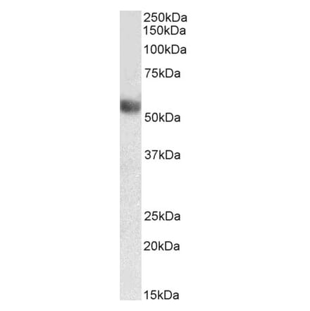 Western Blot - Anti-ILT-7 Antibody (A85256) - Antibodies.com