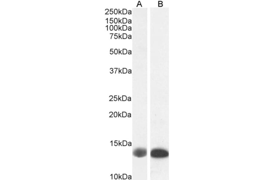 Western Blot - Anti-Liver FABP Antibody (A85257) - Antibodies.com