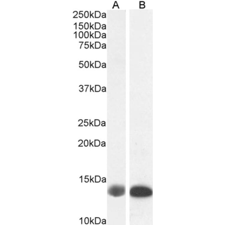 Western Blot - Anti-Liver FABP Antibody (A85257) - Antibodies.com