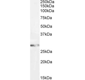 Western Blot - Anti-GSTM3 Antibody (A85258) - Antibodies.com