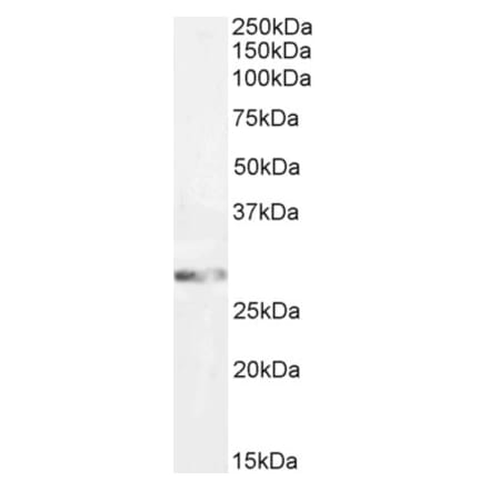 Western Blot - Anti-GSTM3 Antibody (A85258) - Antibodies.com