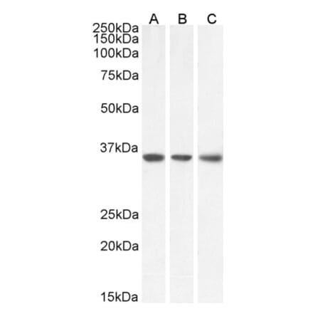 Western Blot - Anti-MDH2 Antibody (A85259) - Antibodies.com