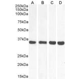 Western Blot - Anti-MDH2 Antibody (A85259) - Antibodies.com