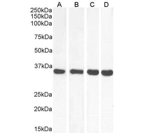 Western Blot - Anti-MDH2 Antibody (A85259) - Antibodies.com