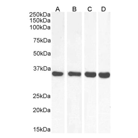 Western Blot - Anti-MDH2 Antibody (A85259) - Antibodies.com