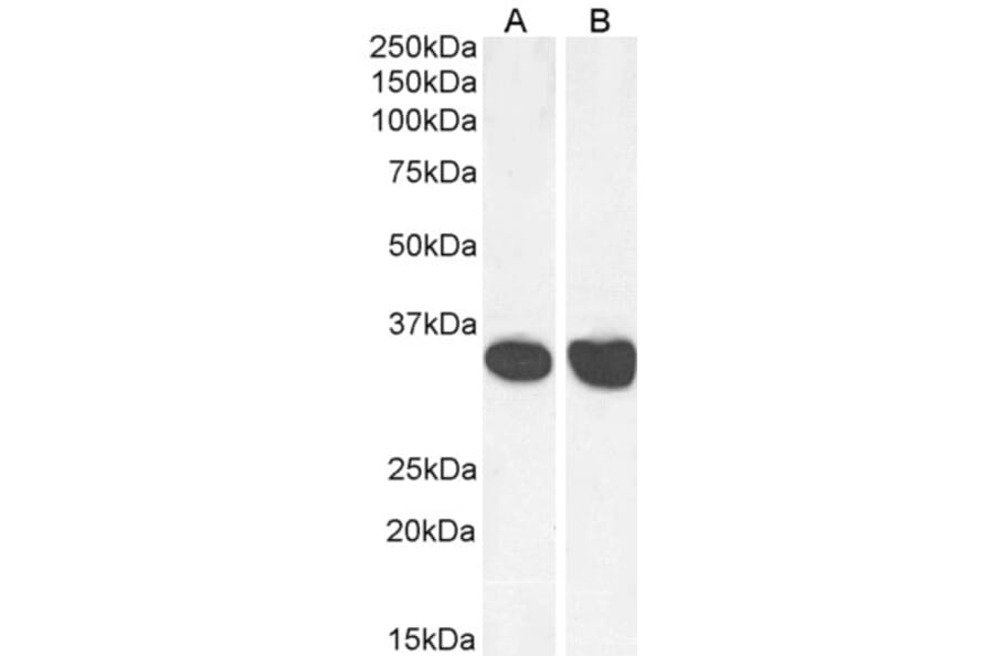 Western Blot - Anti-MDH2 Antibody (A85260) - Antibodies.com