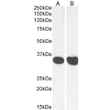 Western Blot - Anti-MDH2 Antibody (A85260) - Antibodies.com