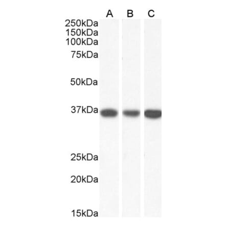Western Blot - Anti-MDH2 Antibody (A85260) - Antibodies.com