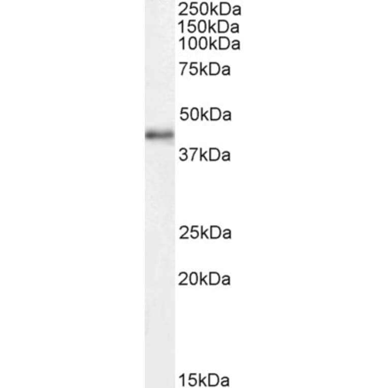 Western Blot - Anti-Cdk9 Antibody (A85261) - Antibodies.com