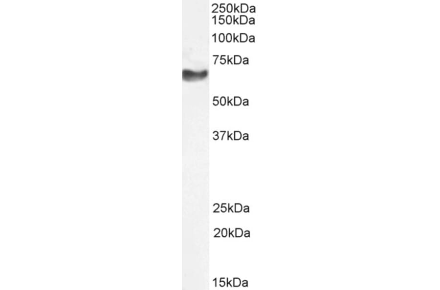 Western Blot - Anti-68kDa Neurofilament/NF-L Antibody (A85263) - Antibodies.com