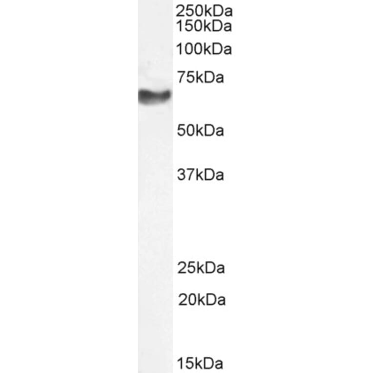 Western Blot - Anti-68kDa Neurofilament/NF-L Antibody (A85263) - Antibodies.com