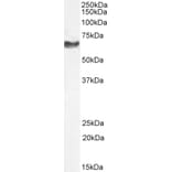 Western Blot - Anti-68kDa Neurofilament/NF-L Antibody (A85263) - Antibodies.com