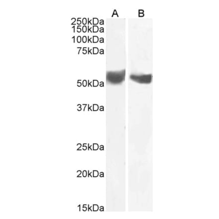 Western Blot - Anti-CD276 Antibody (A85264) - Antibodies.com