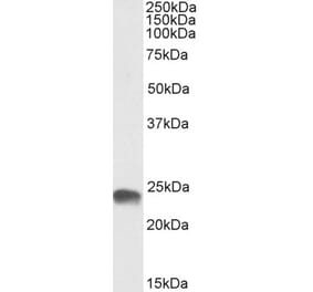 Western Blot - Anti-GSTA3 Antibody (A85265) - Antibodies.com