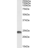 Western Blot - Anti-GSTA3 Antibody (A85265) - Antibodies.com