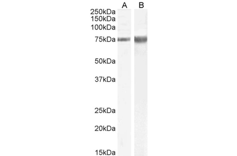 Western Blot - Anti-IB-1 Antibody (A85266) - Antibodies.com