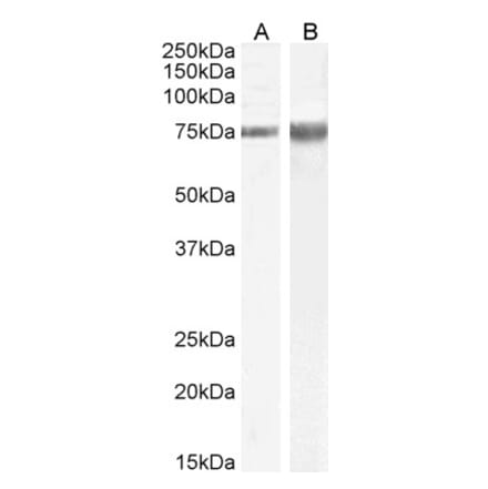 Western Blot - Anti-IB-1 Antibody (A85266) - Antibodies.com