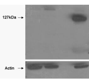 Western Blot - Anti-Tankyrase 2 Antibody (A85269) - Antibodies.com