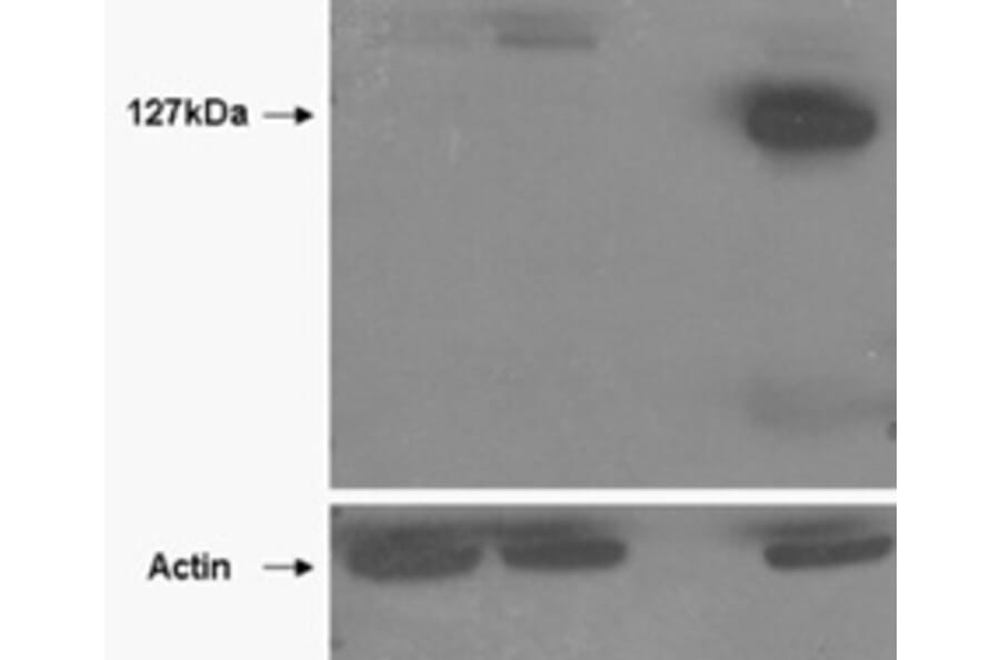 Western Blot - Anti-Tankyrase 2 Antibody (A85269) - Antibodies.com