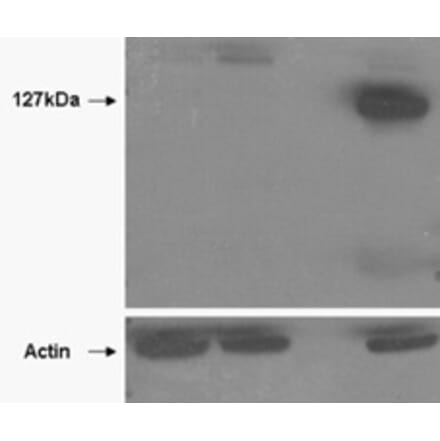 Western Blot - Anti-Tankyrase 2 Antibody (A85269) - Antibodies.com
