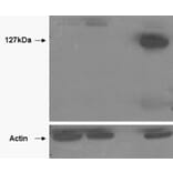 Western Blot - Anti-Tankyrase 2 Antibody (A85269) - Antibodies.com