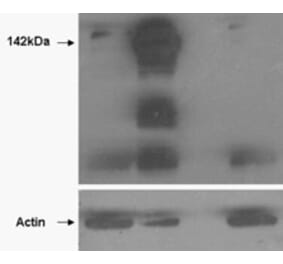 Western Blot - Anti-Tankyrase Antibody (A85270) - Antibodies.com