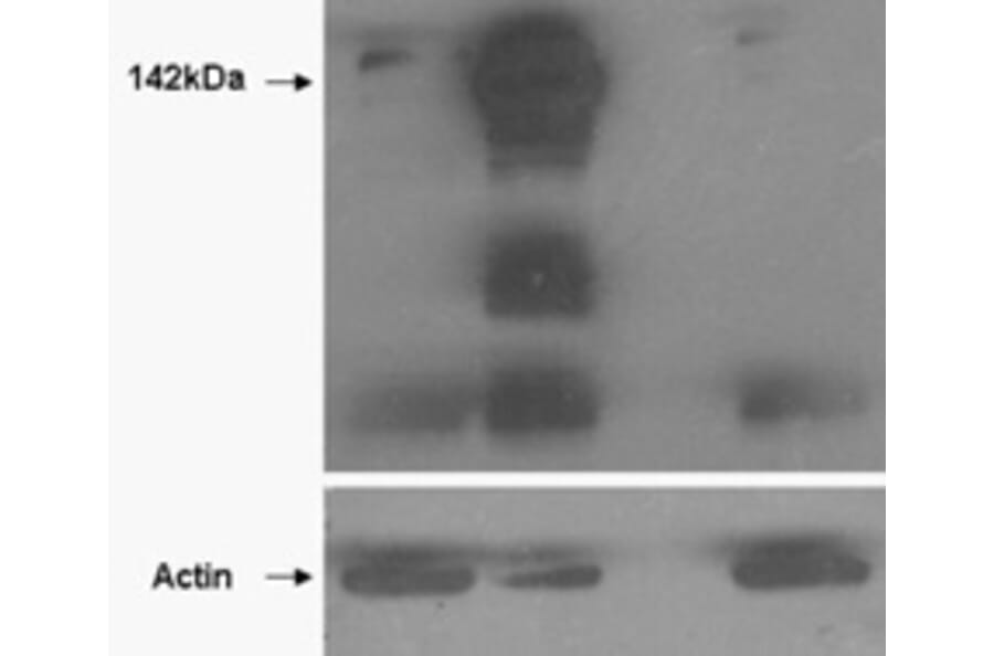 Western Blot - Anti-Tankyrase Antibody (A85270) - Antibodies.com