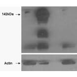 Western Blot - Anti-Tankyrase Antibody (A85270) - Antibodies.com
