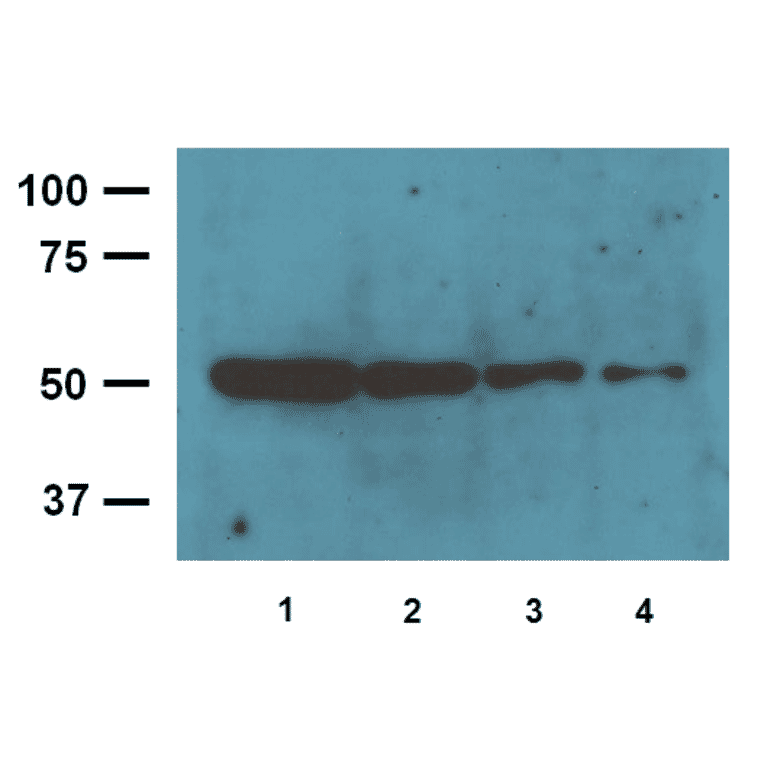 Western Blot - Anti-ß-Tubulin Antibody (A85273) - Antibodies.com