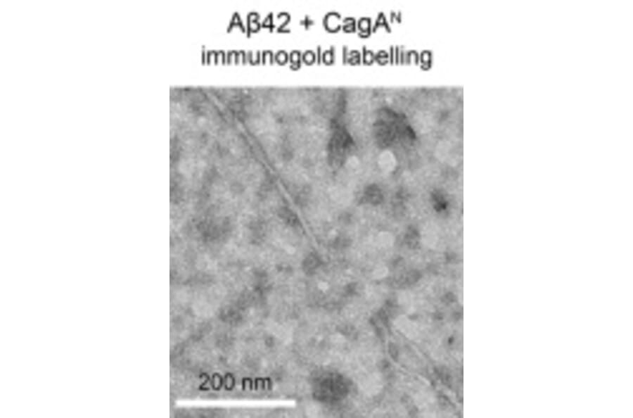 TEM - Anti-His Tag Antibody [HIS.H8] - Antibodies.com