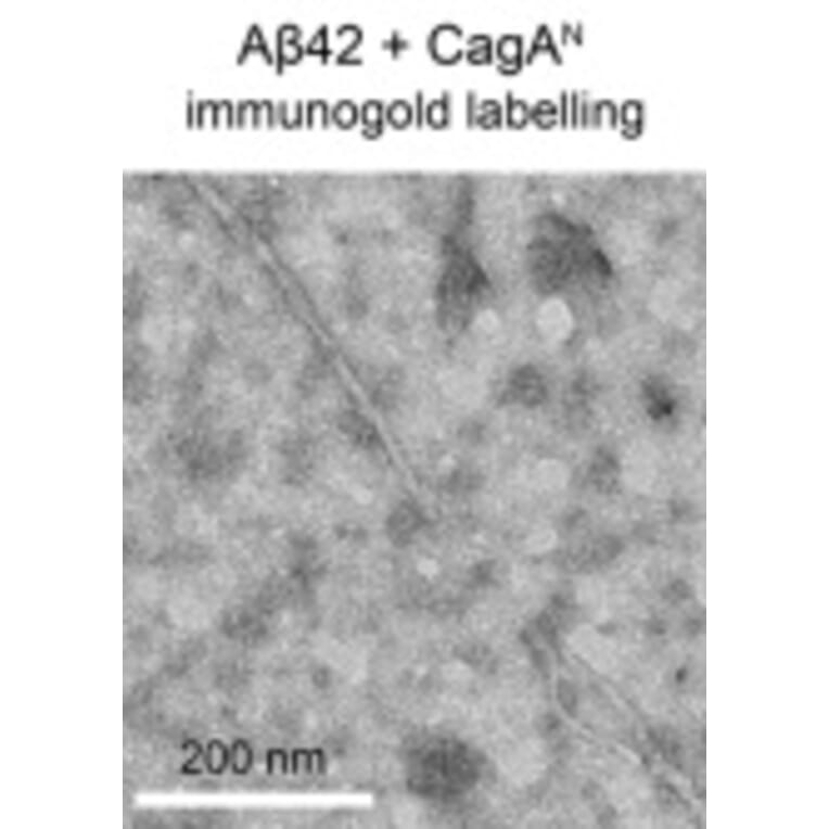 TEM - Anti-His Tag Antibody [HIS.H8] - Antibodies.com