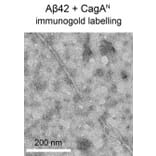 TEM - Anti-His Tag Antibody [HIS.H8] - Antibodies.com