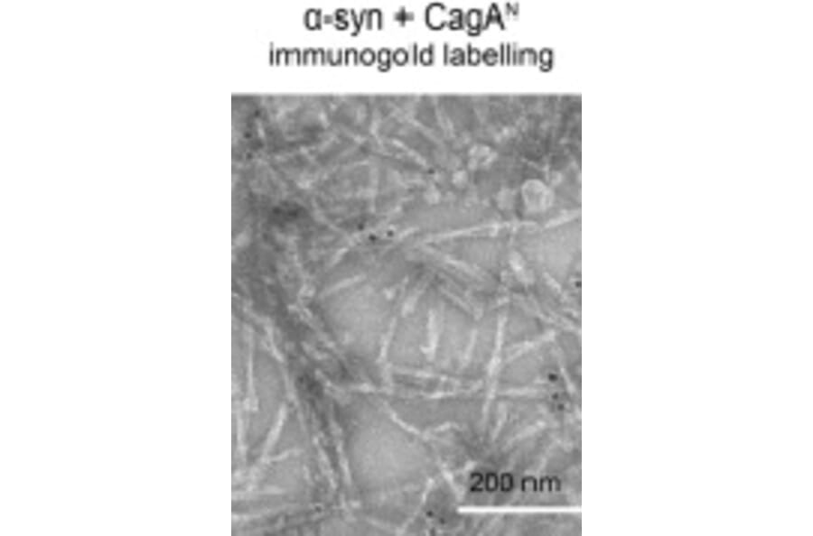 TEM - Anti-His Tag Antibody [HIS.H8] - Antibodies.com