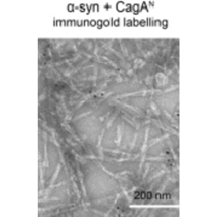 TEM - Anti-His Tag Antibody [HIS.H8] - Antibodies.com