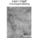 TEM - Anti-His Tag Antibody [HIS.H8] - Antibodies.com