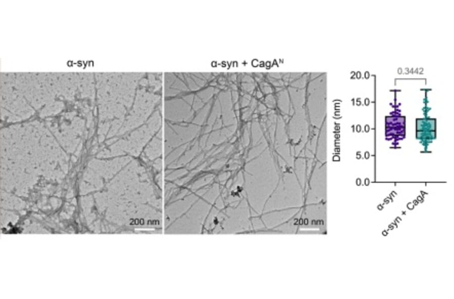 TEM - Anti-His Tag Antibody [HIS.H8] - Antibodies.com
