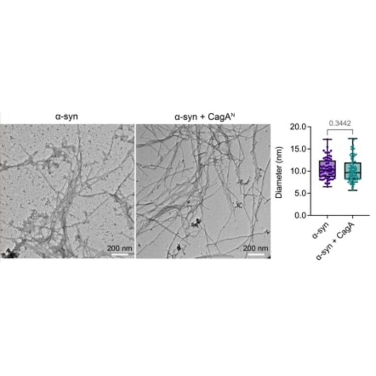 TEM - Anti-His Tag Antibody [HIS.H8] - Antibodies.com