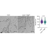 TEM - Anti-His Tag Antibody [HIS.H8] - Antibodies.com