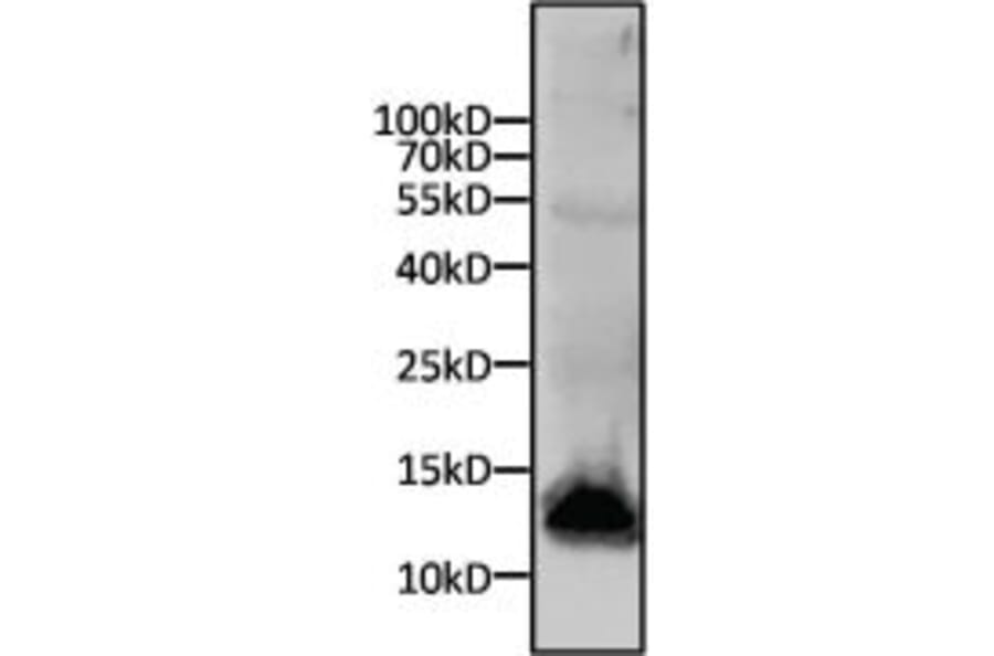 Western Blot - Anti-His Tag Antibody (A85277) - Antibodies.com