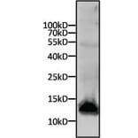 Western Blot - Anti-His Tag Antibody (A85277) - Antibodies.com